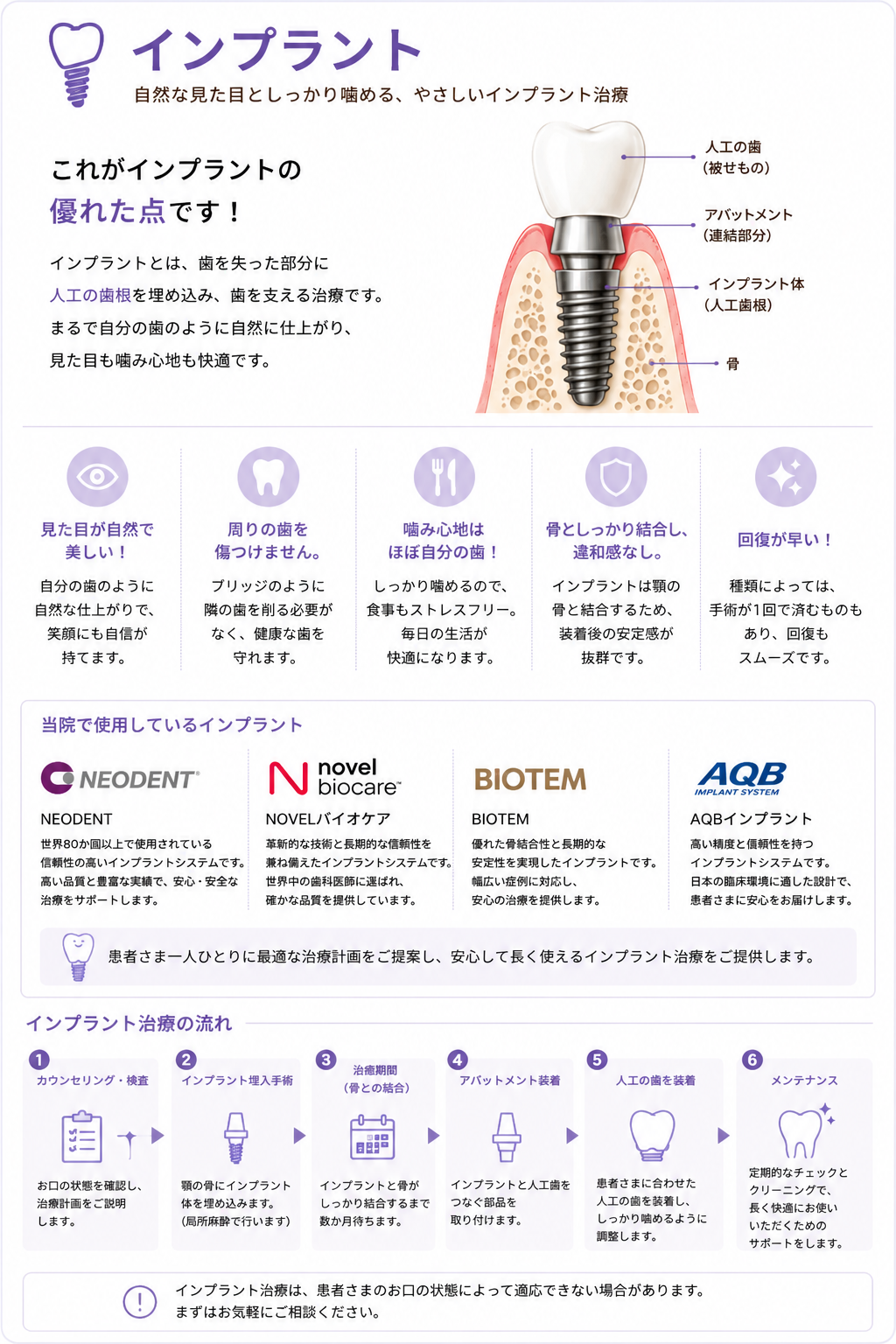 インプラント